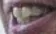 raysmile raysmile