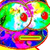 pepohyperacid