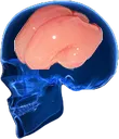 homoskybrain