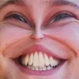 diffHyperS