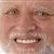 harold