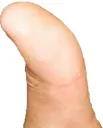 DeerThumb