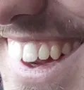 Rdent