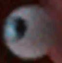eyeball eyeball