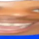 widehardo3