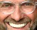 kloppsmile
