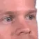 whatBlink