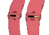 gkrabsquint