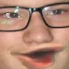 poggert