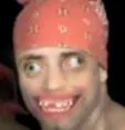 retardo