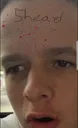 5head