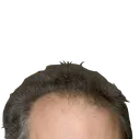 wittenhair