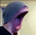 Highpitchednoise