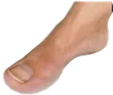 toe