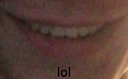 TP_ayolol