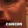cancer