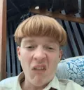 lipbite