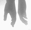 a_handhold