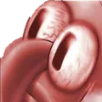SquidwardTriggered