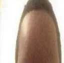 fohead