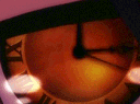 PAM_EYE