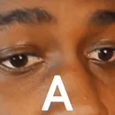 z_a