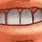 Teef Teef