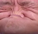 pain