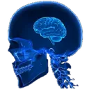FI55_codm_smallbrain