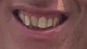 bastarteeth