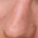 ednose