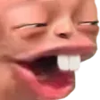 lol