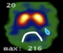 sadbrain
