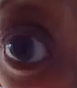 eye eye