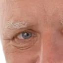 harold1