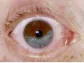 THEEYE