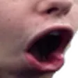 Vis