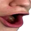 Pog