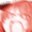 KK_rage