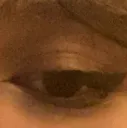 eyeasf