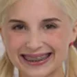 tigzpSmile
