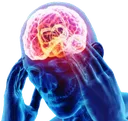 MyBrainHurts