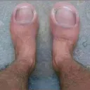 toes