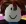 bacon_hair
