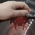 RN_pat