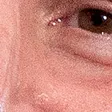 xxxB