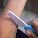 mutilation