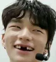 hwanghyunjinwithno_teeth