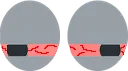 eyes_skooma