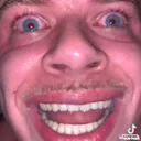 DD